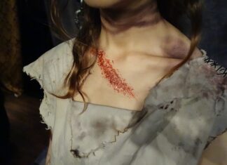 Jak zapobiegać urazom w pracy? Jak zapobiegać urazom w pracy?